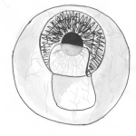 Самогерметизирующиеся разрезы в катарактальной хирургии.
